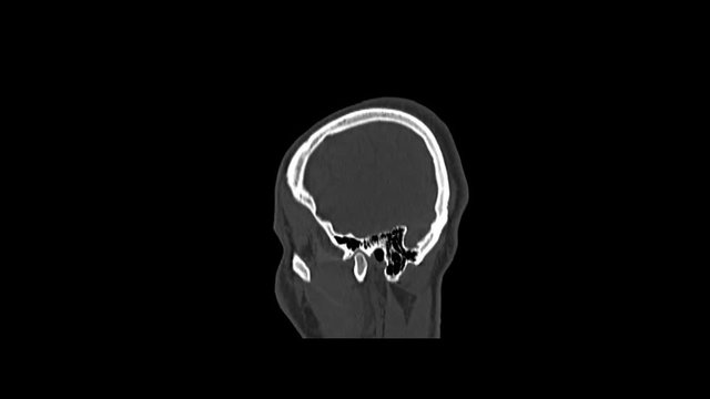 Computed medical tomography MRI scan of healthy male head