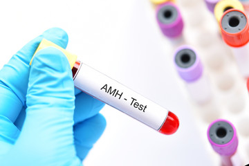 Fototapeta premium Blood sample tube for anti-Müllerian hormone or AMH test 