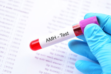 Blood sample tube for anti-Müllerian hormone or AMH test
