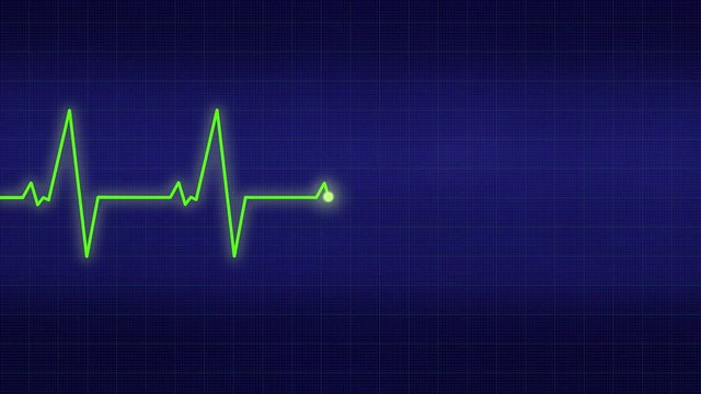 A graph showing a good heartbeat on a blue monitor viewed straight ahead