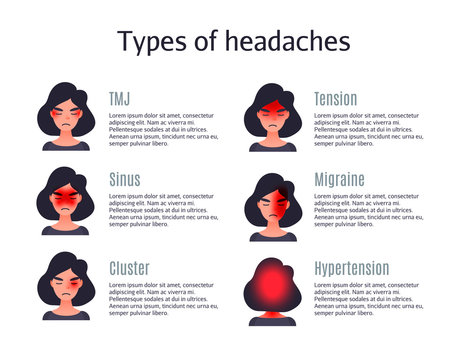 migraine headache diagram