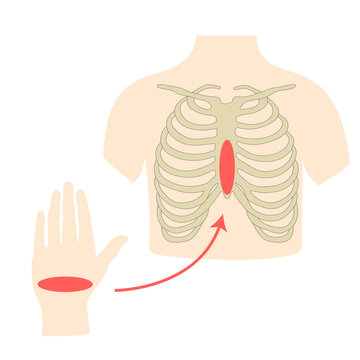 First Aid Training - Cardiopulmonary resuscitation. Proper hand position for CPR.