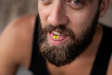 LSD stamp on man's tongue
