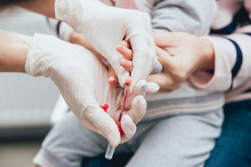 Nurse taking a little child blood sample. Medical equipment.