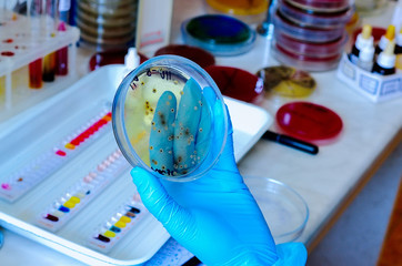 Petri dish. Microbiological laboratory. Mold and fungal cultures. Bacterial research