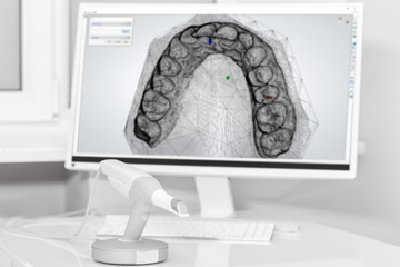 Dental 3d scanner and monitor in the dentist's office