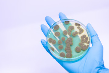 Backgrounds of Penicillium, ascomycetous in petri dish for well as food and drug production.