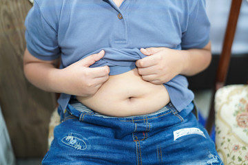 Overweight Asian children young kid  show fat belly.