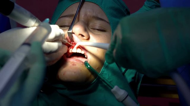 Oral surgery operation,cist apicoectomy, dark operation room