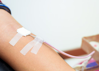 Needle for blood donation. Medical Equipment for blood donor at donation, transfusion. Close up arm...
