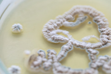 Mold Beautiful, Colony of Characteristics of Fungus (Mold) in culture medium plate from laboratory microbiology.