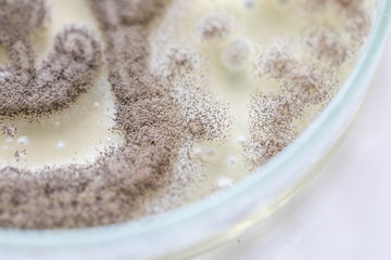 Mold Beautiful, Colony of Characteristics of Fungus (Mold) in culture medium plate from laboratory microbiology.