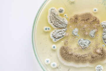 Mold Beautiful, Colony of Characteristics of Fungus (Mold) in culture medium plate from laboratory microbiology.