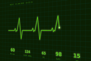 Fototapeta premium Graph of normal heartbeat on the green monitor slightly to the side