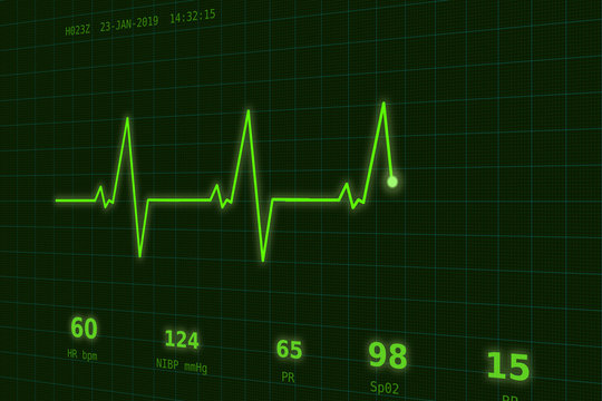Graph of normal heartbeat on the green monitor slightly to the side