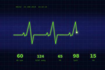 A graph of normal heartbeat on a blue monitor