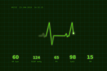 A graph of normal heartbeat on a green monitor