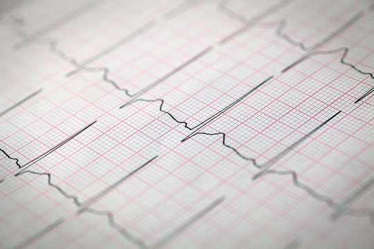 Close-up of an electrocardiogram, Medical and healthcare concept.
