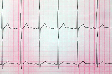 Background of electrocardiogram,  Medical and healthcare concept.