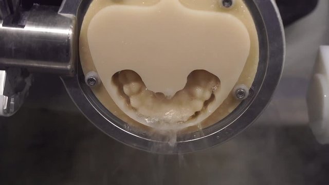 Dental Prof Frizing Equipment in the process of polymer freezing using water