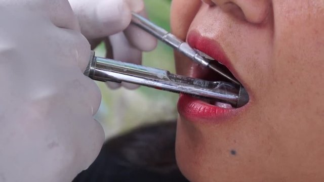 Dental anesthesia injected to female patient
