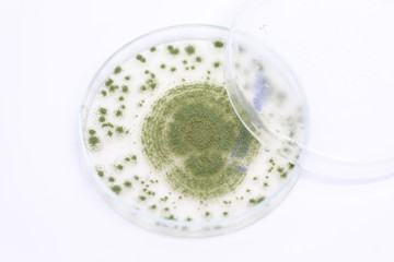 Close up of Aspergillus oryzae is a filamentous fungus, or mold that is used in food production, such as in soybean fermentation for education in laboratory.(soft focus and have Grain/Noise)