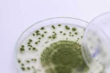 Close up of Aspergillus oryzae is a filamentous fungus, or mold that is used in food production, such as in soybean fermentation for education in laboratory.(soft focus and have Grain/Noise)