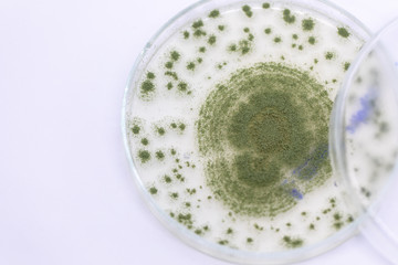 Close up of Aspergillus oryzae is a filamentous fungus, or mold that is used in food production, such as in soybean fermentation for education in laboratory.(soft focus and have Grain/Noise)