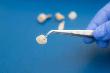 A dentist is holding tweezers for dental ceramic veneers and crowns.