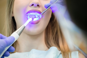 Dentist doing procedure with dental curing UV light in clinic