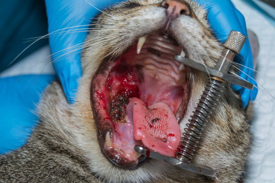 Oral tumor removing