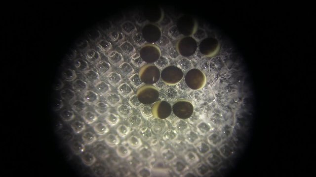 Medical researcher injecting xenopus oocytes with micropipette, under microscope