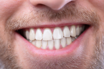 Man With Healthy Teeth