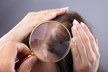 Dermatologist Examining Woman's Hair