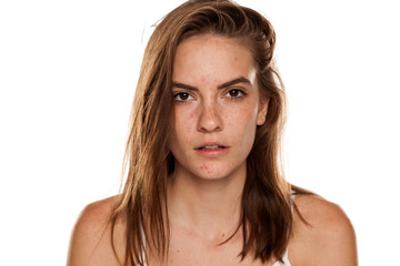 Portrait of young beautiful woman with frackles and problematic skin on white backgeound
