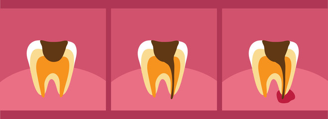 Проблемный зуб