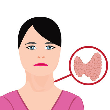 Thyroid disease. Endocrine disfunction vector illustration