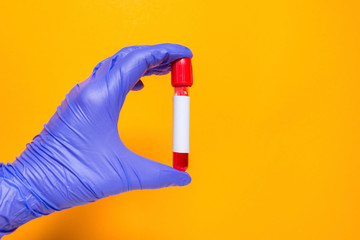 Blood sample in doctor hand