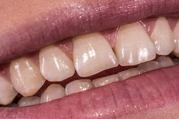 Obraz premium Woman smile with great natural teeth