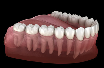Morphology of mandibular human gum and teeth. Medically accurate tooth 3D illustration