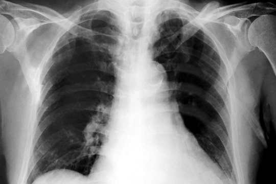 image of x-ray film