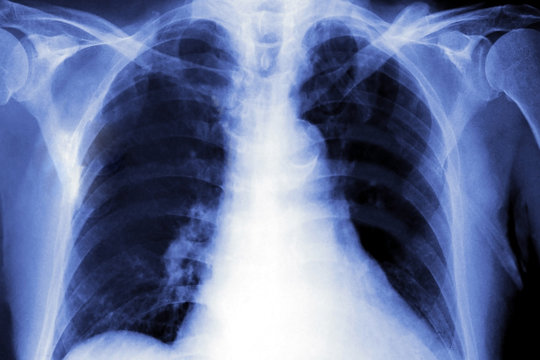 image of x-ray film