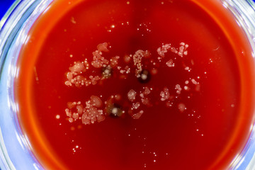 Mold growing in a Petri dish
