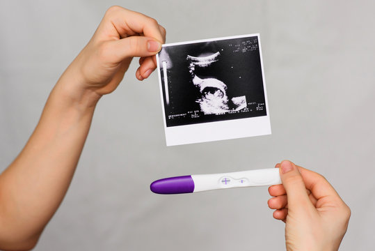 ultrasound picture and positive pregnancy test in the hands of a girl close-up