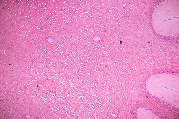 Cross section of the Cerebellum and Nerve human under the microscope for education in Lab.