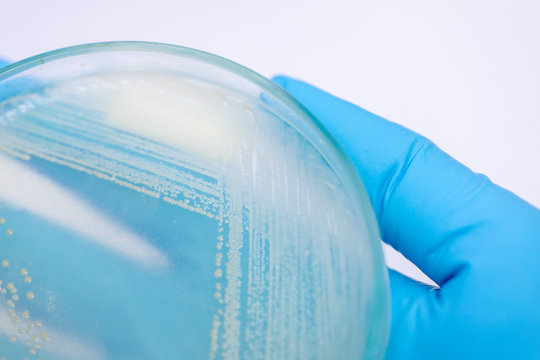 Yeast in petri dish, Microbiology for education in laboratories.