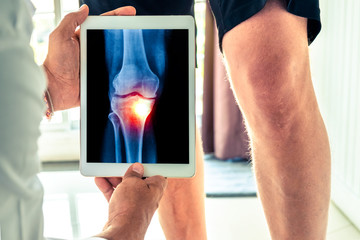 Doctor holding a digital tablet with x-ray of knee of the patient