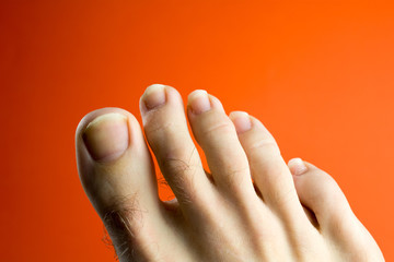 ugly toenails red background. pedicure service concept, can be used before and after comparison