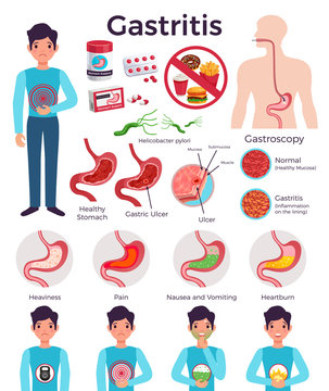 Gastritis Infographic Elements Set