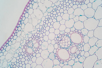 Cross sections of plant stem under microscope view.